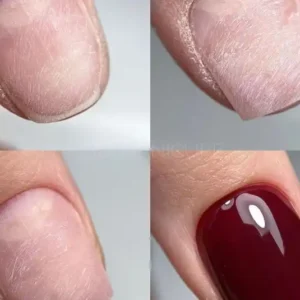 Nail Repair per finger