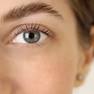 Brows Lifting