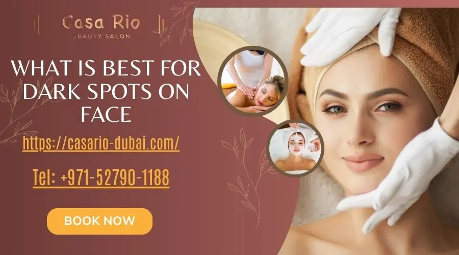 what is best for dark spots on face