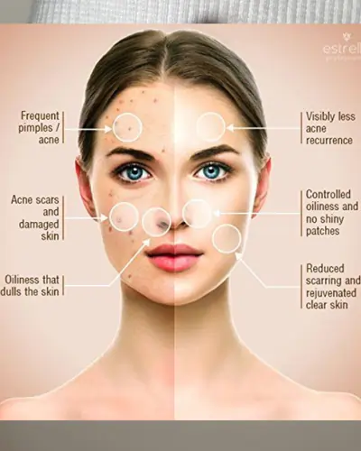 What to Expect During the Treatment