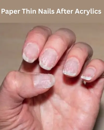 Paper Thin Nails After Acrylics Paper Thin Nails After Acrylics